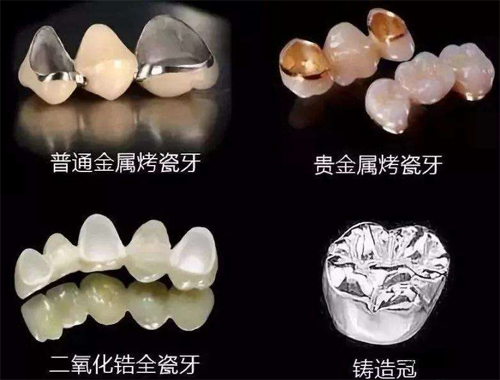 不同牙冠对比图