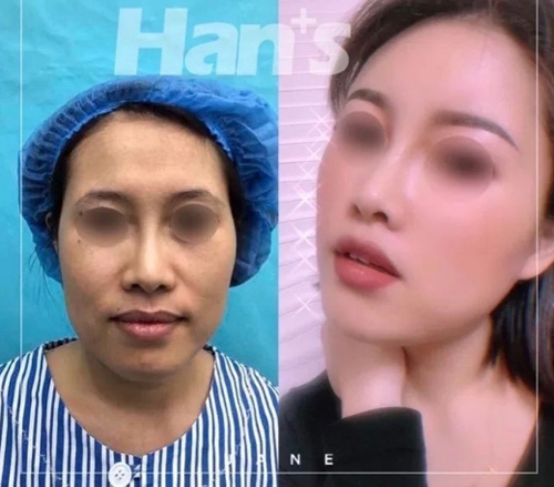 曝光济南韩氏整形医院价格，年终回馈价格让人心动！