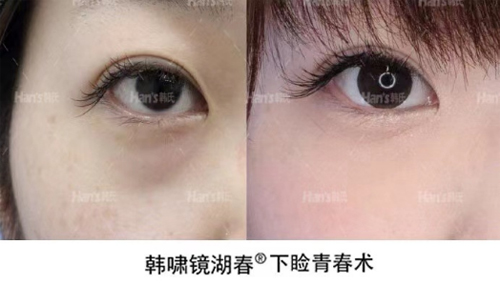曝光济南韩氏整形医院价格，年终回馈价格让人心动！