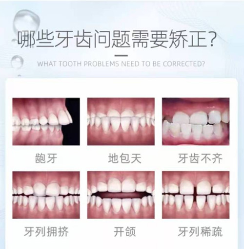 濟南牙齒做正畸比較好的醫(yī)院有哪些