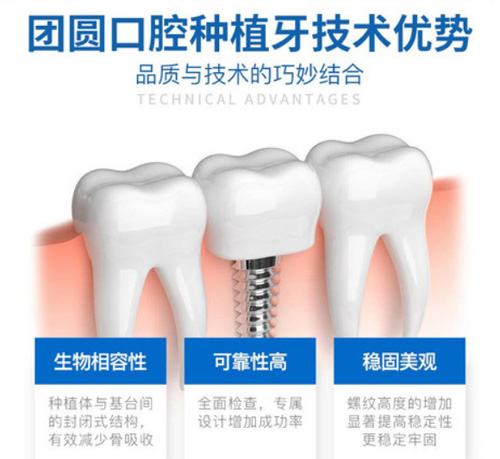 西安种牙比较好的医院汇总，揭秘西安哪里种植牙好！