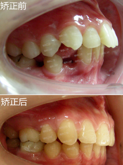 桂林周瑾帆口腔牙齒矯正