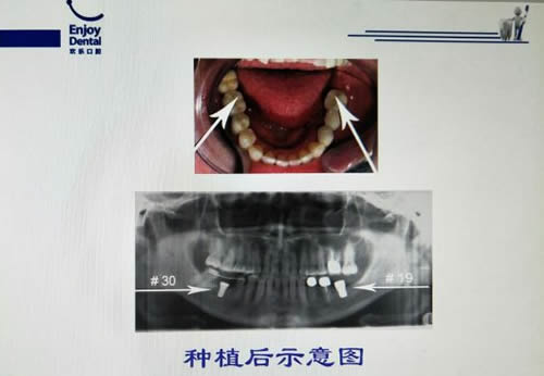 北京歡樂(lè)口腔優(yōu)勢(shì)分析