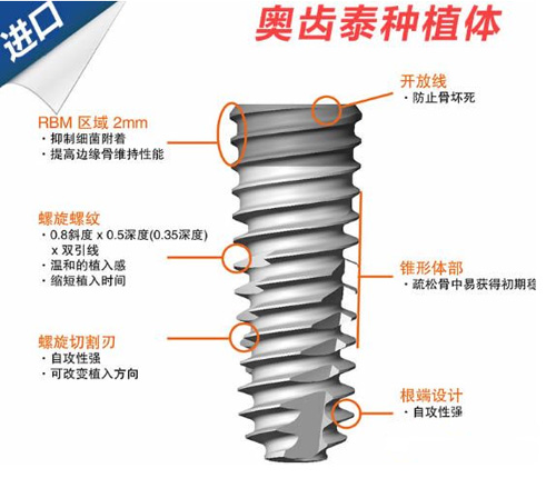 韩国奥齿泰种植牙质量怎么样？科普分析osstem种植体怎么样!