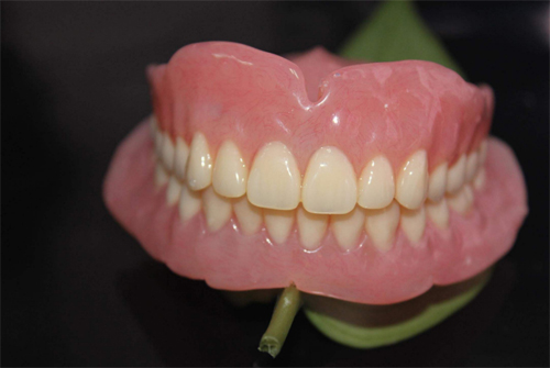 吸附性义齿模型展示