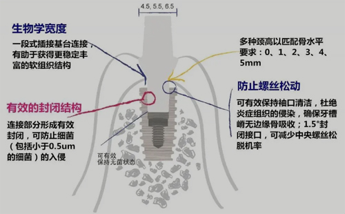 仕诺康种植体多少钱一颗?分析韩国仕诺康种植体怎样及型号!