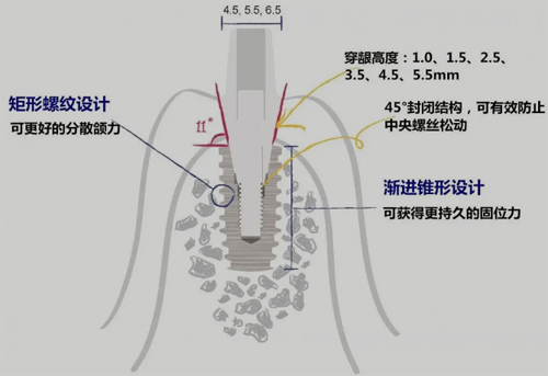 仕诺康种植体多少钱一颗?分析韩国仕诺康种植体怎样及型号!