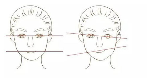 面部磨骨常见后遗症不对称