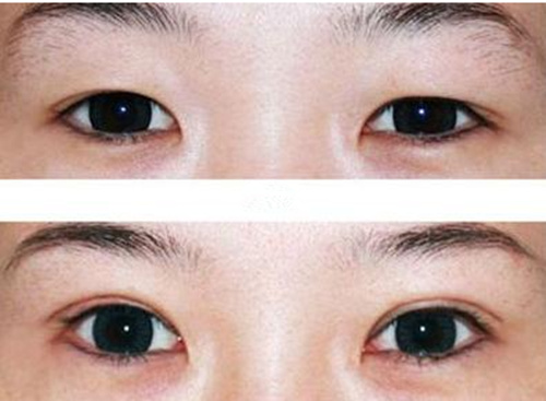 洛阳做双眼皮好的整形医院有哪些？都有什么特色？