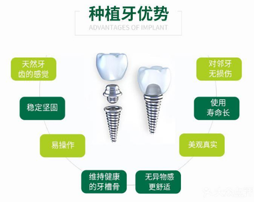 种植牙多少钱一颗2020？分析正规种牙一颗需要多少钱！