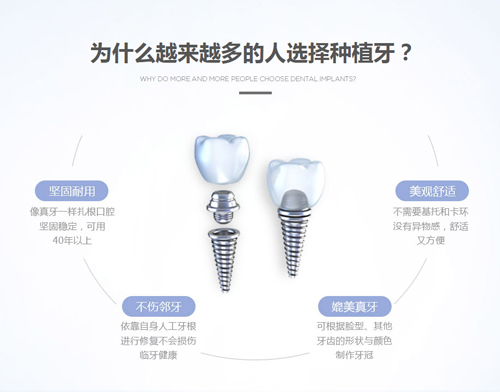 种植牙多少钱一颗2020？分析正规种牙一颗需要多少钱！