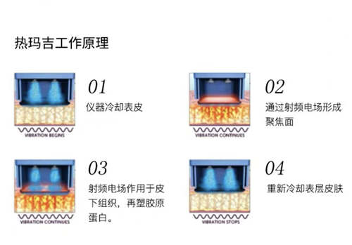 2021国内热玛吉面部除皱价格透明吗？我花15000能做吗？