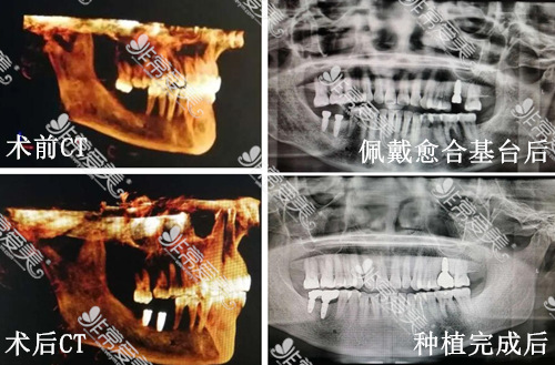 嘉兴看牙齿比较好的医院分享，在哪里、优势统统告诉你！