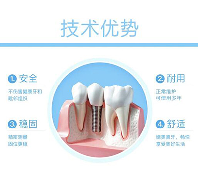 唐山种植牙哪家医院好，做种植3980元一颗还带冠划算吗？