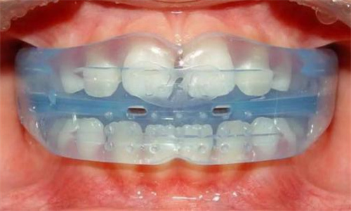 咸阳儿童牙科哪几家好？盘点咸阳好的儿牙医院！