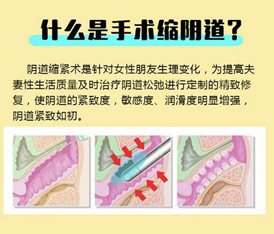 长沙做私密整形医院哪家好？手术紧致这三家口碑还不错！