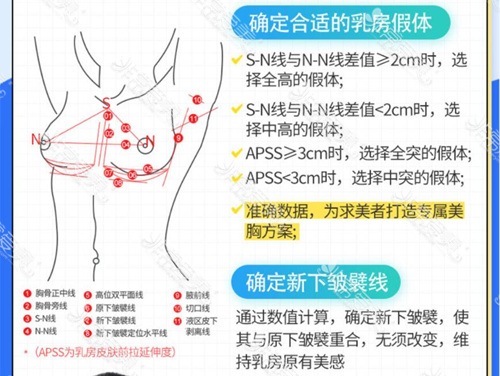 深圳富华:双平面内窥镜隆胸没有那么神,平安疗效好是重点！