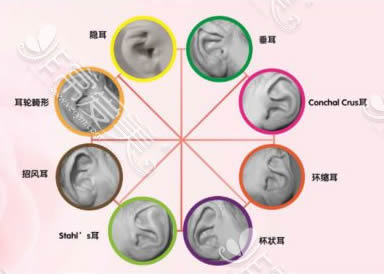 北京煤医整形耳再造技术是真的吗,医生手术费用是多少?