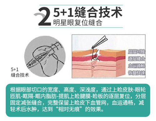 东莞做双眼皮哪个医院好，分享本地做眼睛正规医院合集！