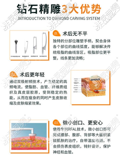 钻石精雕吸脂术怎么样钻石精雕吸脂价格高不高