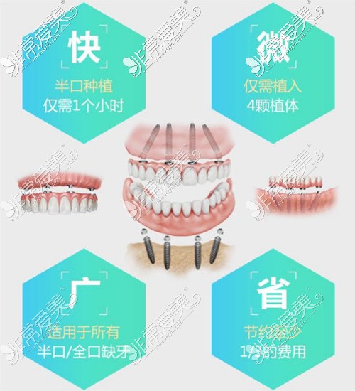 70岁老人全口假牙价目表公布,装一口假牙需要多少钱?