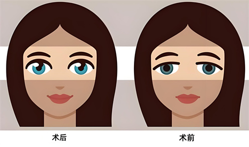 广西整形医院排名前三的是南宁爱思特整形/华美整形/韩美整形,都是正规靠谱口碑好的整形机构!