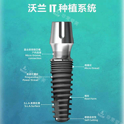 韩国沃兰种植体