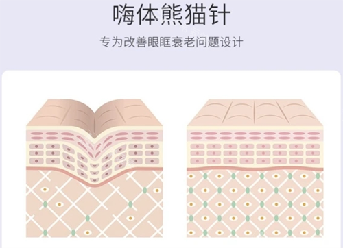 嗨体熊猫针皮肤组织动画展示