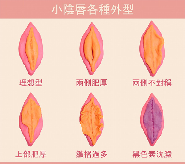 成都美容整形医院私密科卵巢保养好吗？定制化方案超贴心，搭配私密脱毛、3D生物束带等优质项目，私密护理一站搞定！