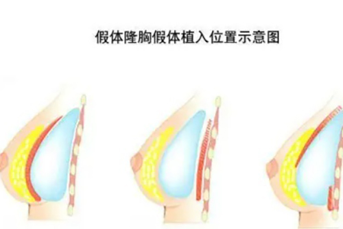 邯郸美弧美润医疗美容官网简介:眼综合/假体隆胸预约+位置在丛台区+项目价目及就诊流程官网可查询