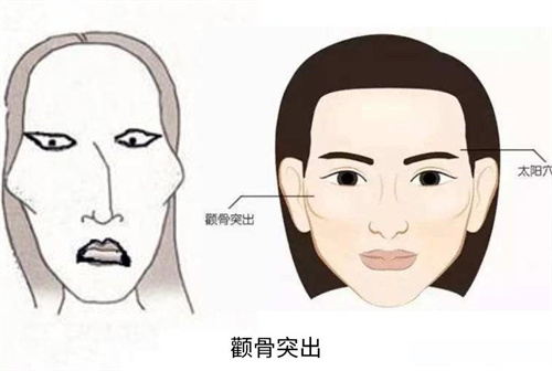 重庆做颧骨缩小磨骨手术哪家好？松山整形/铜雀台/星荣整形都有资质且技术靠谱！