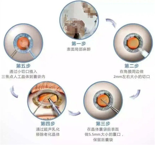 韩国WJ原辰整形休息区