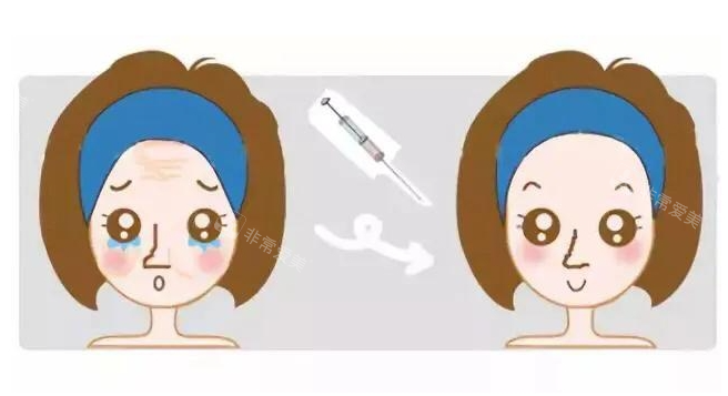 眼部注射前后对比图