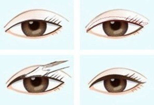 眼线1