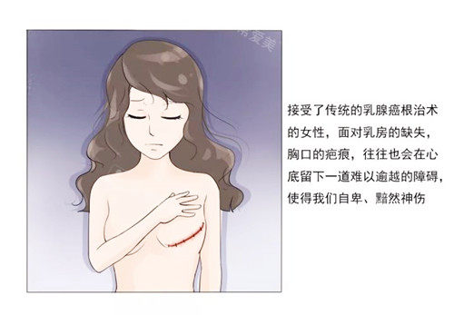 乳房重建手术
