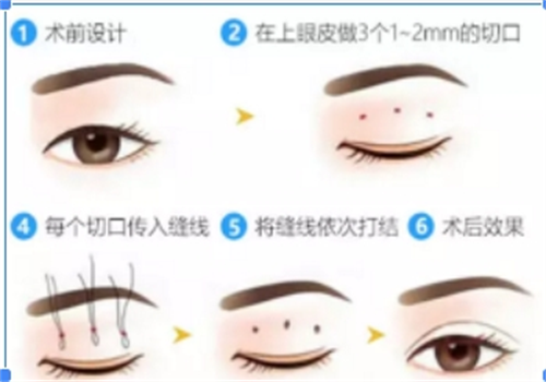 成都圣之隅整形预约挂号方便吗？简介显实力+口碑超靠谱，轻松约到心仪变漂亮服务！