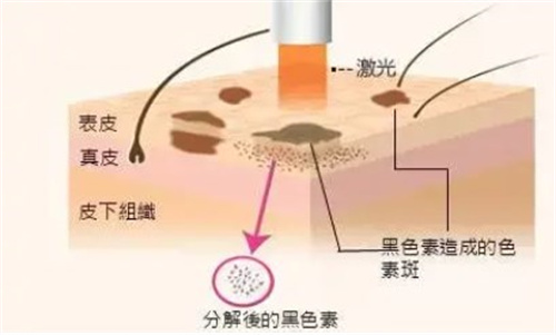 青岛祛斑正规医院排名榜:博士医学美容/灿辰波罗蜜医疗美容都设备全是网友认可的!