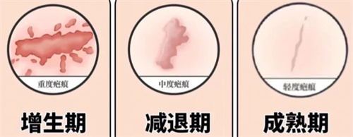 韩国做眼角修复靠谱医院整理！大眼睛整形/爱护整形/必当归整形都是靠谱的医院！