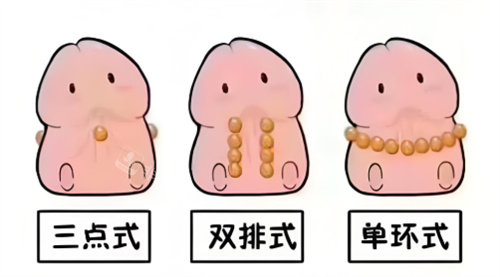 入珠手术动画2