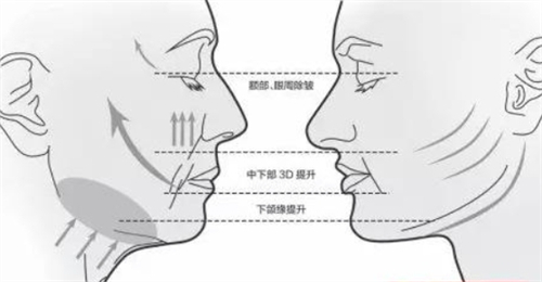 成都素美医疗美容咋样？看简介实力超硬核，项目多元超靠谱！