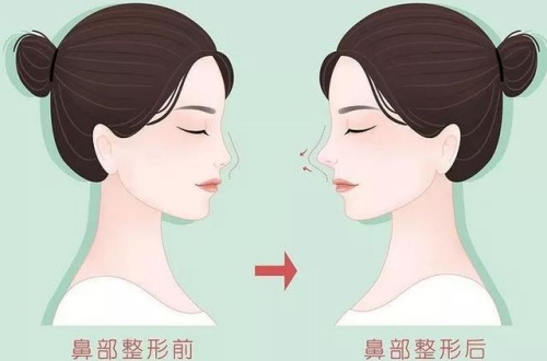 韩国neo整形医院怎么样？口碑好吗？公布简介/地址/擅长项目/口碑评价/预约方式！