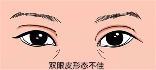 广西医科大学第一附属医院整形外科怎么样？分享简介介绍+地址路线+擅长项目+预约挂号方式！