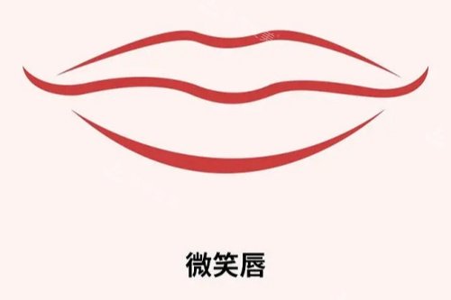 微笑唇展示图