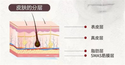 softwave索夫波适用皮肤层次