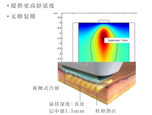 softwave索夫波功效