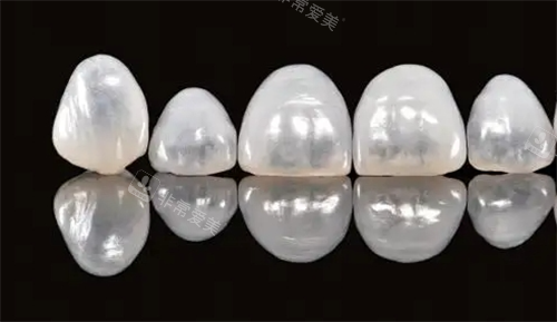 德国vita全瓷牙展示图