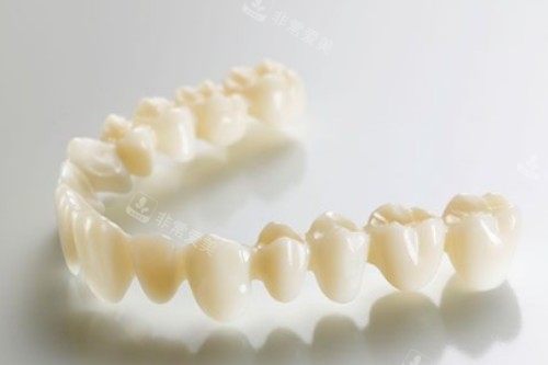 全瓷牙冠卡通图片展示