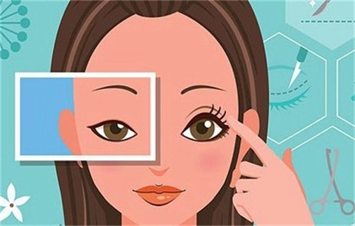 曾翾双眼皮修复技术在上海排名前五！这是整友2025年给出的全新评价哦！