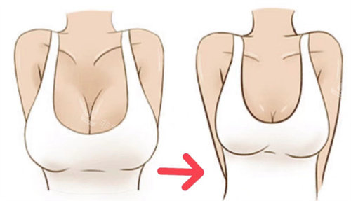 巨乳缩小卡通
