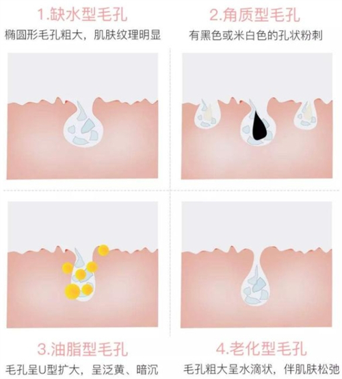 韩国legato2仪器改善毛孔和面部小疤痕真的很有一套!
